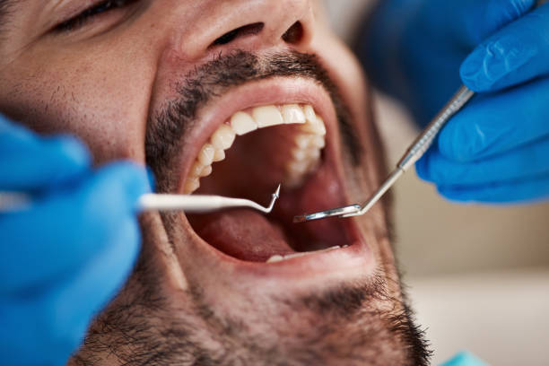 Best Pediatric Emergency Dentist in West Frankfort, IL